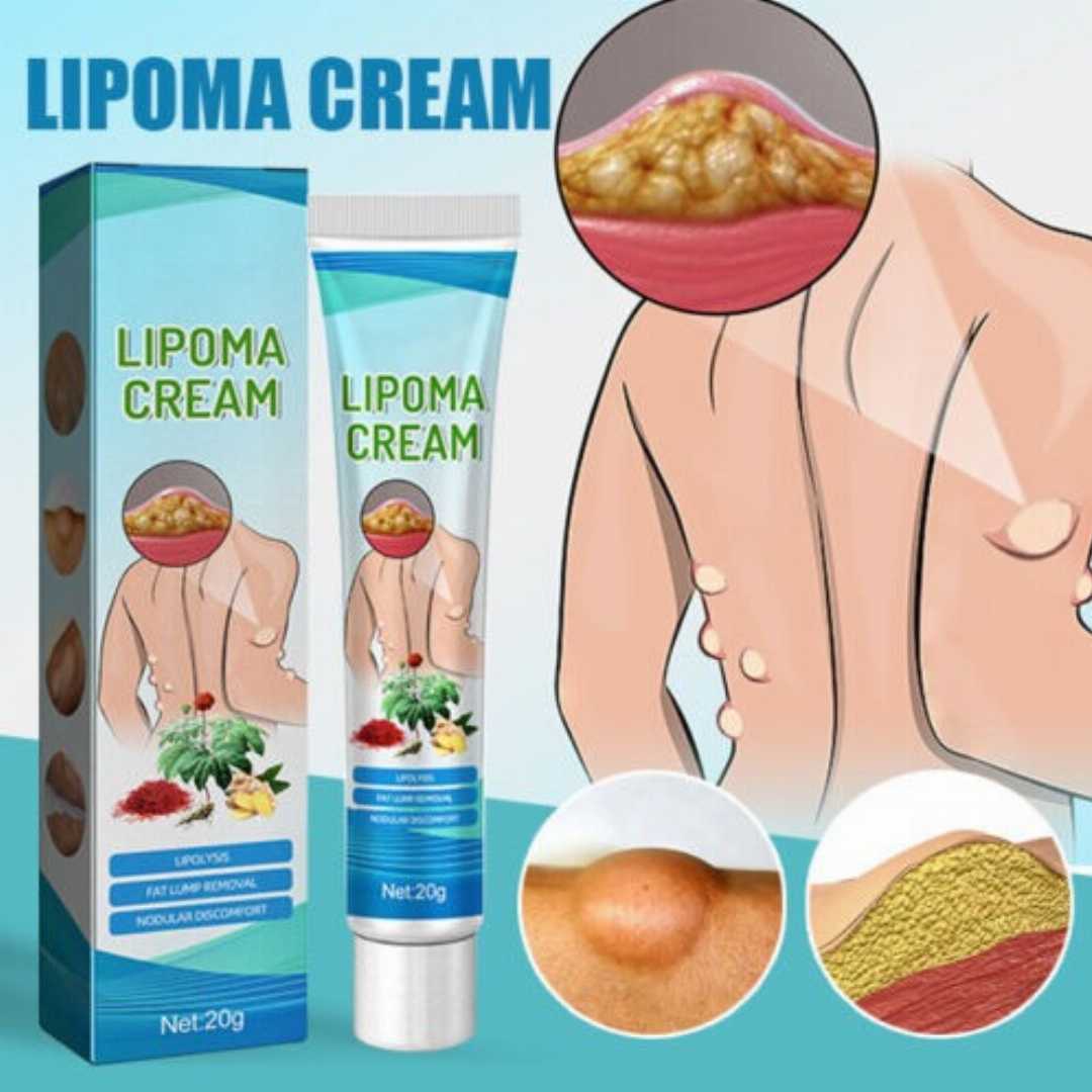 Lipoma Treatment Ointment